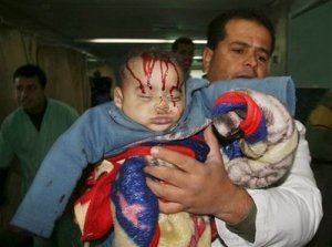 အစၥေရးစစ္တပ္၏တ�ုက္ခ�ုက္မွဳေၾကာင့္ဒဏ္ရာရသြားေသာပါလစတ�ုင္းကေလးငယ္