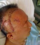 ေဆးရံုေပၚ မွ PAD ေခါင္းေဆာင္ ဆြန္ထိ လင္ေသာင္ကူး ဓာတ္ပံု-ေနးရွင္း 